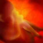 Hebrew University Researchers Create Embryo Stem Cells From Skin Cells