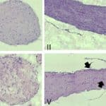 Bar-Ilan Study: Your Stressed-Out Bacteria Could Trigger Autoimmune Response