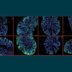 BGU Study: Blood-Brain Barrier Damage Occurs Even With Mild Head Trauma