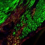 Blue-Sky Dye Spells Hope for Improving Heart Function