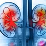 Could new Israeli technique spell the end of dialysis?