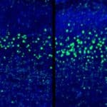 How do viral infections in pregnancy affect the embryos’ brain?