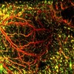 Imaging Technique Combines Light and Sound to Monitor Drug Response