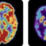 Israeli scientists shed new light on how the brain functions