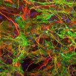 Israeli treatment could delay deadly effects of ALS – new study