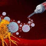 Predicting Immunotherapy Success