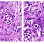 A New Approach to Tailoring Cancer Therapy: Tapping into Signaling Activities in Cancer Cells