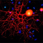 Weizmann Institute Scientists Find that Targeting a Chronic Pain Gateway Could Bring Relief