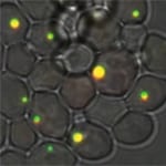 Dropping in: How Street-Corner Organelles Come Together