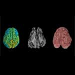 Technion discovers how to reduce cognitive damage from brain disease