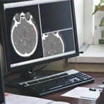 TAU study showed increased amygdala volume in brain after lockdown