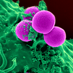 Gut bacteria linked to weight gain following chemotherapy treatment for breast cancer