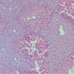 Gut microbes and host cells jointly contribute to the progression of this mostly incurable disease