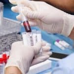 Israeli scientists bid goodbye to biopsies with blood test