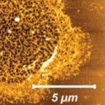 Killing Them Softly – With Proteasomes