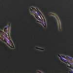 TAU researchers develop method to fight bacteria resistant to antibiotics