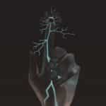 TAU technology restores the sense of touch in nerves damaged as a result of amputation or injury