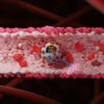 COVID proteins that trigger strokes and heart attacks identified by Israeli team