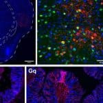 Can our brain make our body sick? Likely yes, Israeli research shows