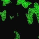 Israeli lab finds out why some germs dodge drugs, opening door to life-saving fix