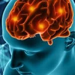 Israeli drug candidate slows Alzheimer’s-causing protein in mouse brains
