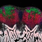 A Matter of Survival: How the Immune System Sets Priorities