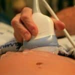 Prenatal ultrasound can spot early signs of autism, Israeli research finds