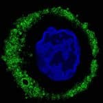 Antibodies Fight Cancer Too