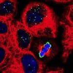CRISPR gene editing may cause permanent damage – study