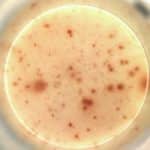 Genome tech raises hopes of a single injection for HIV patients