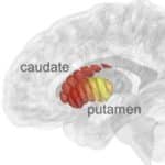 Israeli lab says it developed brain scan to make early Parkinson’s screening routine