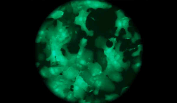 Gut research