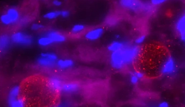 Itay_Raphael_Reprogramming_the_tumor-immune_niche