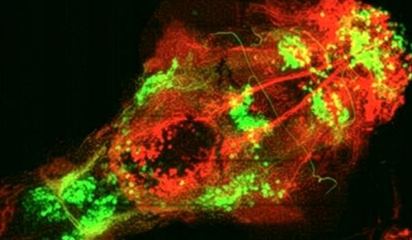 Limor_Freifeld_Tools_for_seeing_and_influencing_the_brain