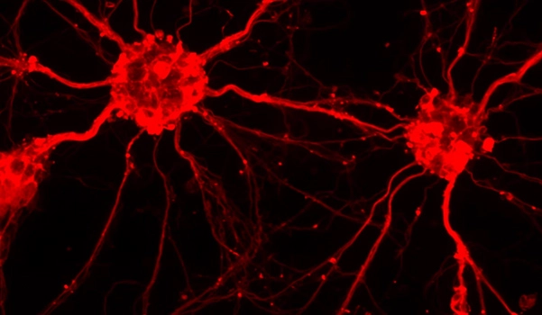 Maya_Maor-Nof_Development_and_neuronal_resilience
